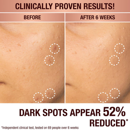Charlotte Tilbury Radiance Recovery Dark Spot Serum - Tranexamic Acid & Vitamin C Serum for Brighter Looking Under Eyes, Redness, Uneven Skin Tone - Treatment to Reduce Appearance of Aging Skin