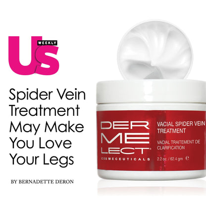 Dermelect Vacial Spider Vein Treatment for Body & Face Anti Aging Cream with Vitamin K, Allantoin, Hyaluronic Acid, Arnica, Shea Butter for Spider Veins, Red Threads, Uneven Skintone 2.2 oz