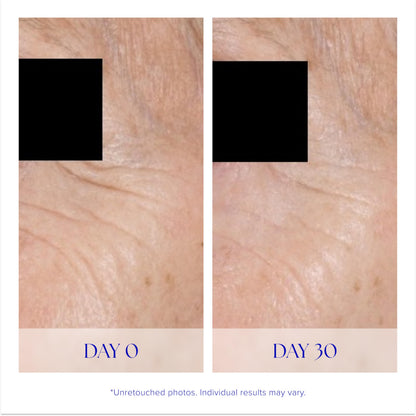 iS CLINICAL Youth Eye Complex, Anti-Aging Brightening Under Eye Cream, Reduces Puffiness, Hydrating and Firming Eye Cream
