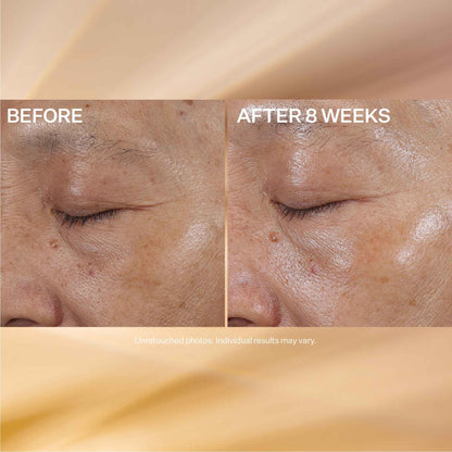 StriVectin Super-C Eye Vitamin C Eye Cream, Brightening and Firming, Boost Skin Dullness with Hyaluronic Acid