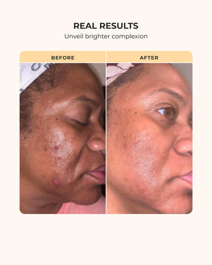 Buttah Skin Transforming Kit for Melanin Rich Skin | CocoShea Revitalizing Cream 2 oz | Vitamin C Serum 1 oz | Buttah Cleanser 3.4 oz | Black Owned Skincare