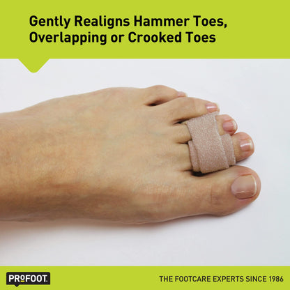 PROFOOT Toe Straight Hammertoe Wrap, Toe Straightener to Realign Overlapping or Crooked Toes, Hammer Toe Corrector for Women & Men, Non-Bulky, One Size Fits All, 1 Pair
