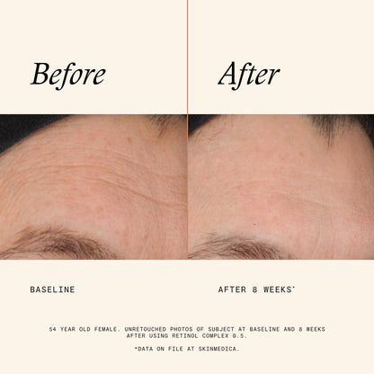 SkinMedica Retinol 0.5 Complex, 1 oz.