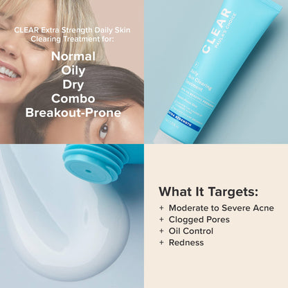 Paula's Choice CLEAR Daily Skin Clearing Cream, All Over Face Acne Treatment with Benzoyl Peroxide, Treats and Prevents Mild to Severe Acne & Breakouts, Fragrance-Free, 2.25 fl oz