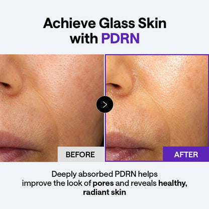 Mediheal Derma Cream - Pore Care Moisturizer with Niacinamide, Adenosine & Squalane - Skin Elasticity Support & Deep Hydration with Lightweight, Non-Greasy Texture (1.69 fl. oz.)