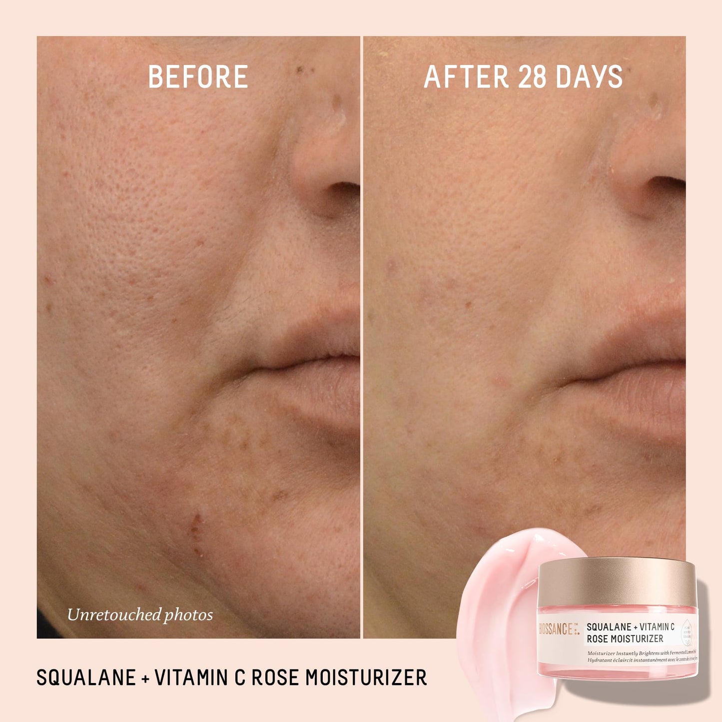 Biossance Squalane + Vitamin C Rose Face Moisturizer – Antioxidant-Rich Day/Night Face Lotion – Hydrates and Smooths Fine Lines – Even Skin Tone & Reduce Discoloration – For Radiant Skin, 1.69 Fl Oz