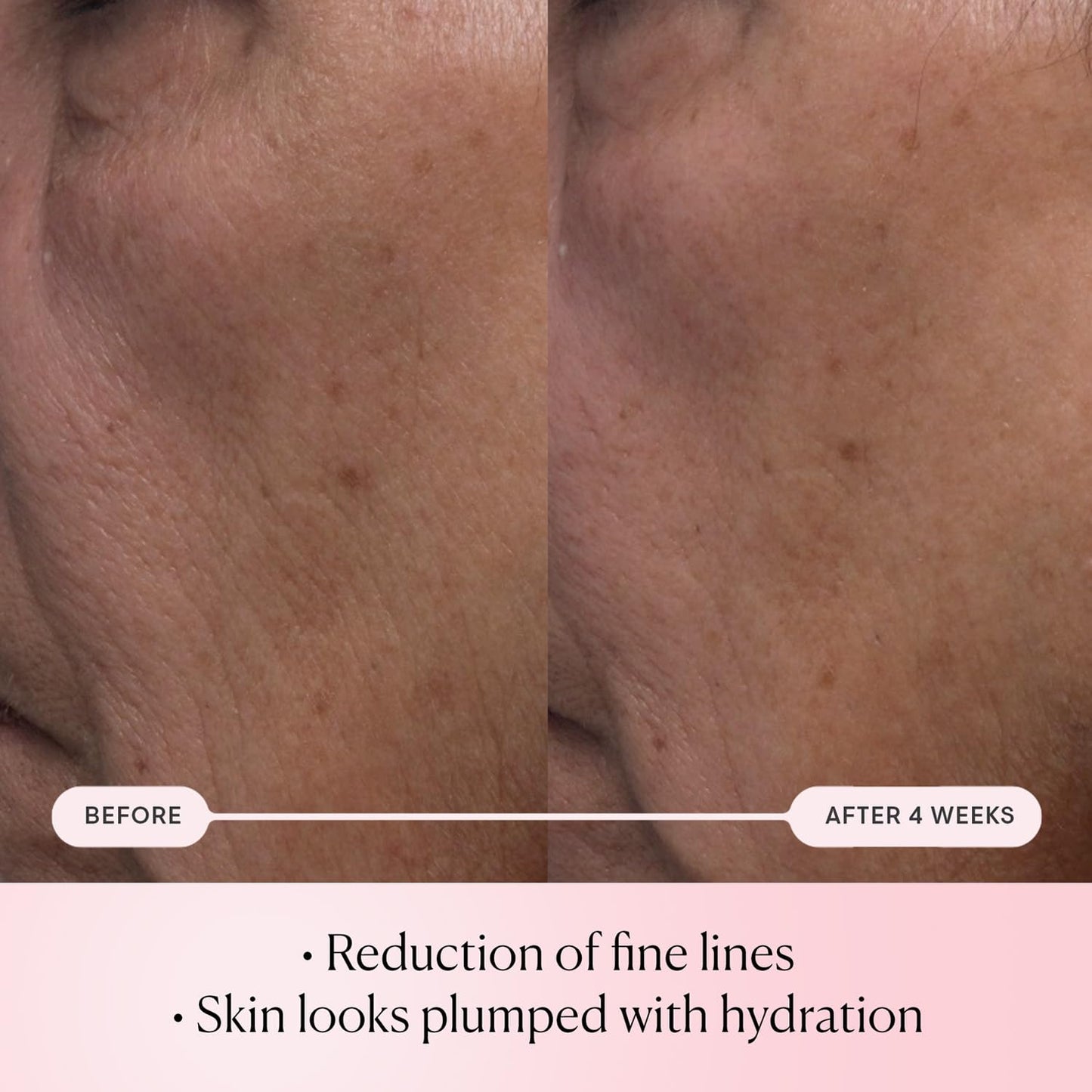 ELEMIS Pro-Collagen Rose Micro Serum | Hydration serum that plumps, soothes, and nourishes your skin while reducing fine lines & wrinkles.