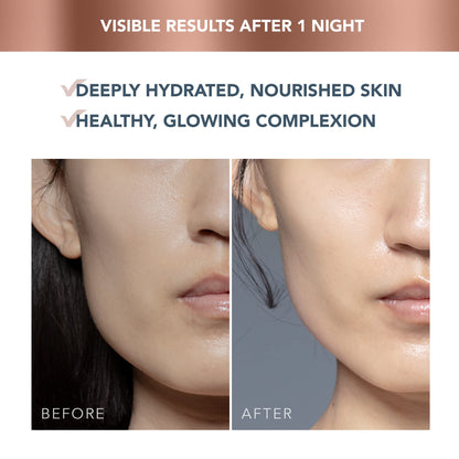 FOREO SUPERCHARGED Ultra hydrating Night Mask - Night Face Moisturizer - Deeply Replenishing Moisturizer Face Cream - Rejuvenating - Vegan - Cruelty & Gluten-Free - 2.5 oz