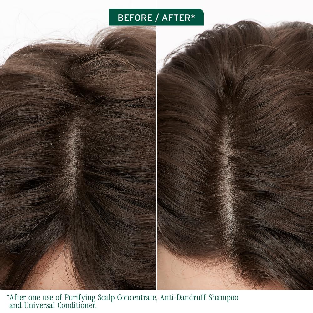 Biolage Scalp Sync Purifying Concentrate - Exfoliating & Clarifying Dry Scalp Treatment, Refreshing & Reinvigorating, Fermented Tea Blend & Glycolic Acid