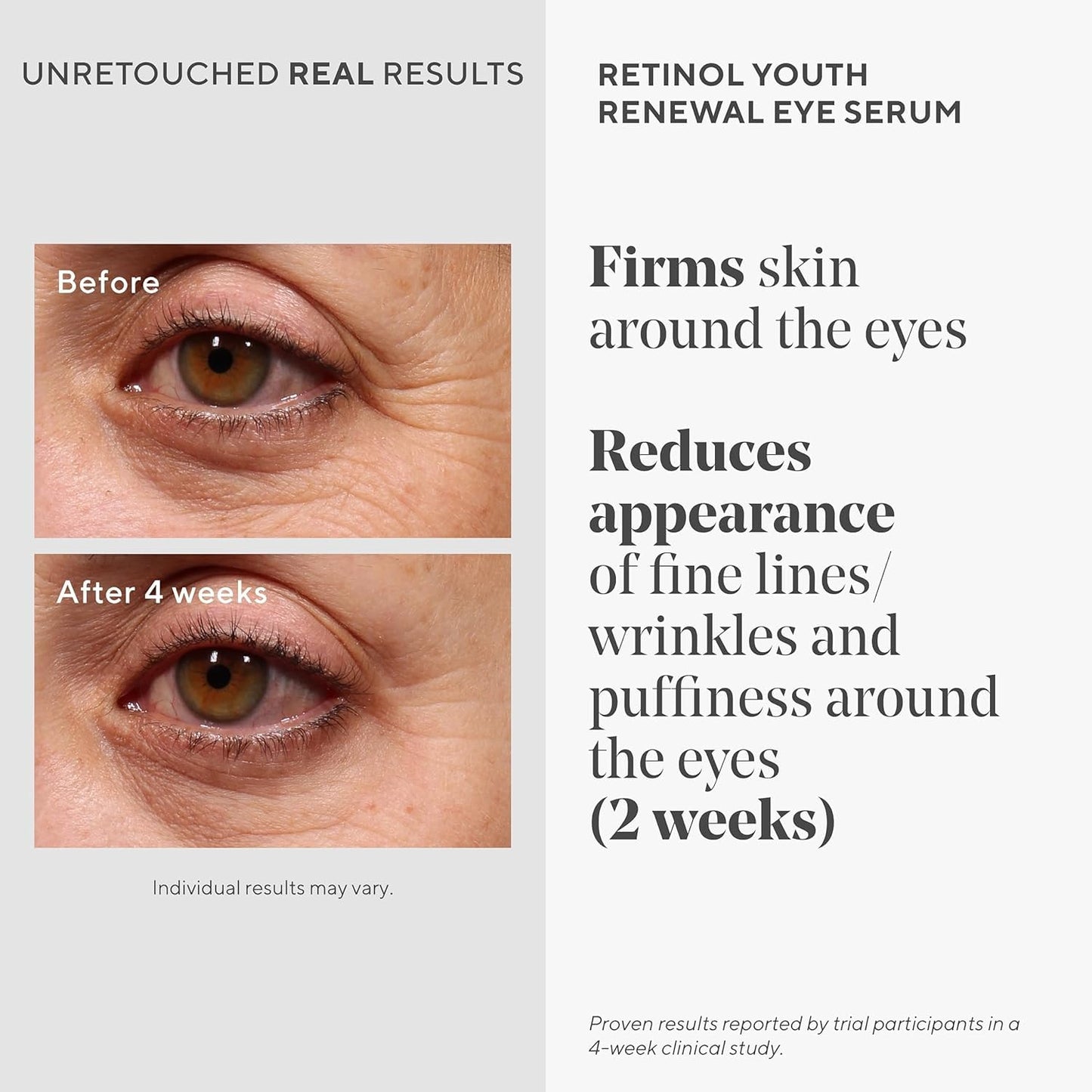 Murad Retinal Trial Kit - Lift and Resculpt with Retinal 2-Piece Trial Kit ($73 Value) - Anti-Aging Set Encapsulated Retinal - Retinal Serum 0.5Fl Oz, Retinal Eye Cream 0.11Fl Oz