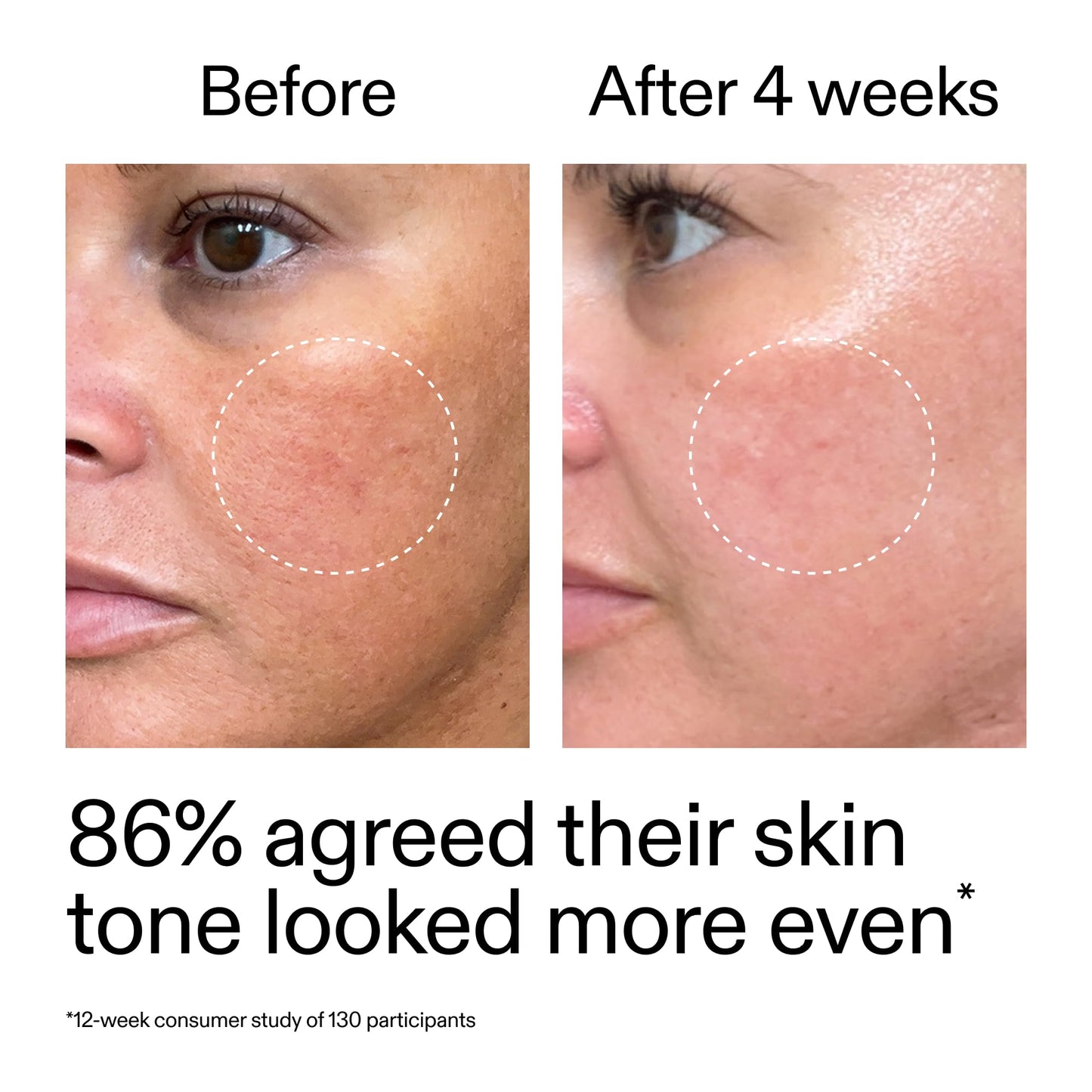 The INKEY List Starter Dual Retinol Serum 1 Fl Oz, 0.5% Amisol Trio & 0.2% Symrelief, Gentle Skin Renewal, Smooths Fine Lines, Hydration & Barrier Protection, Suitable for Sensitive Skin