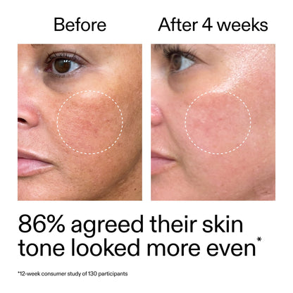 The INKEY List Starter Dual Retinol Serum 1 Fl Oz, 0.5% Amisol Trio & 0.2% Symrelief, Gentle Skin Renewal, Smooths Fine Lines, Hydration & Barrier Protection, Suitable for Sensitive Skin