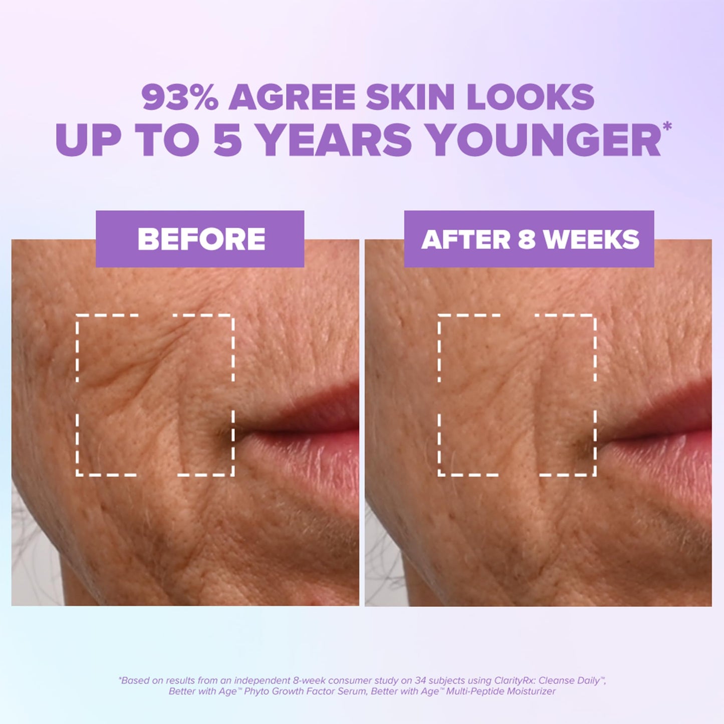 ClarityRx Better With Age Phyto Growth Factor Face Serum, 0.9 Fl Oz, Anti-Aging Hydrating Serum with Plant Stem Cells, Helps Support Collagen & Hyaluronic Acid Production, Visibly Smooths Fine Lines