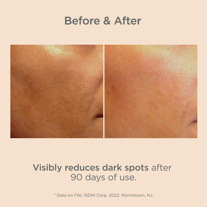 ISDIN Isdinceutics Melaclear Dark Spot Correcting Serum for Face - Sun Spot Reducer that Contains Vitamin C and Antioxidants, to Even Skin Tone from Sun Exposure 0.5 FL OZ