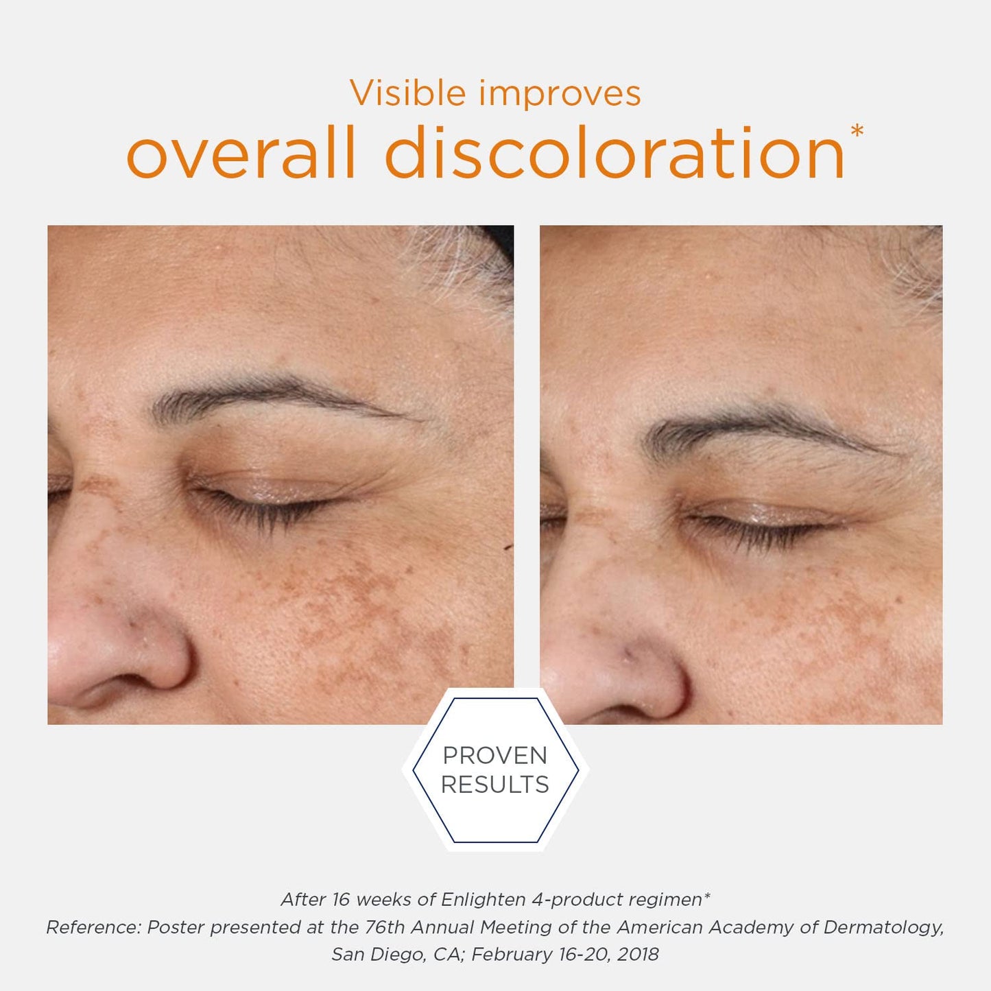 NEOSTRATA Enlighten Brightening Serums for Uneven Tone