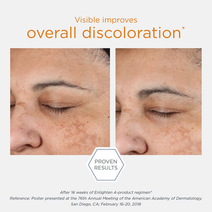 NEOSTRATA Enlighten Brightening Serums for Uneven Tone