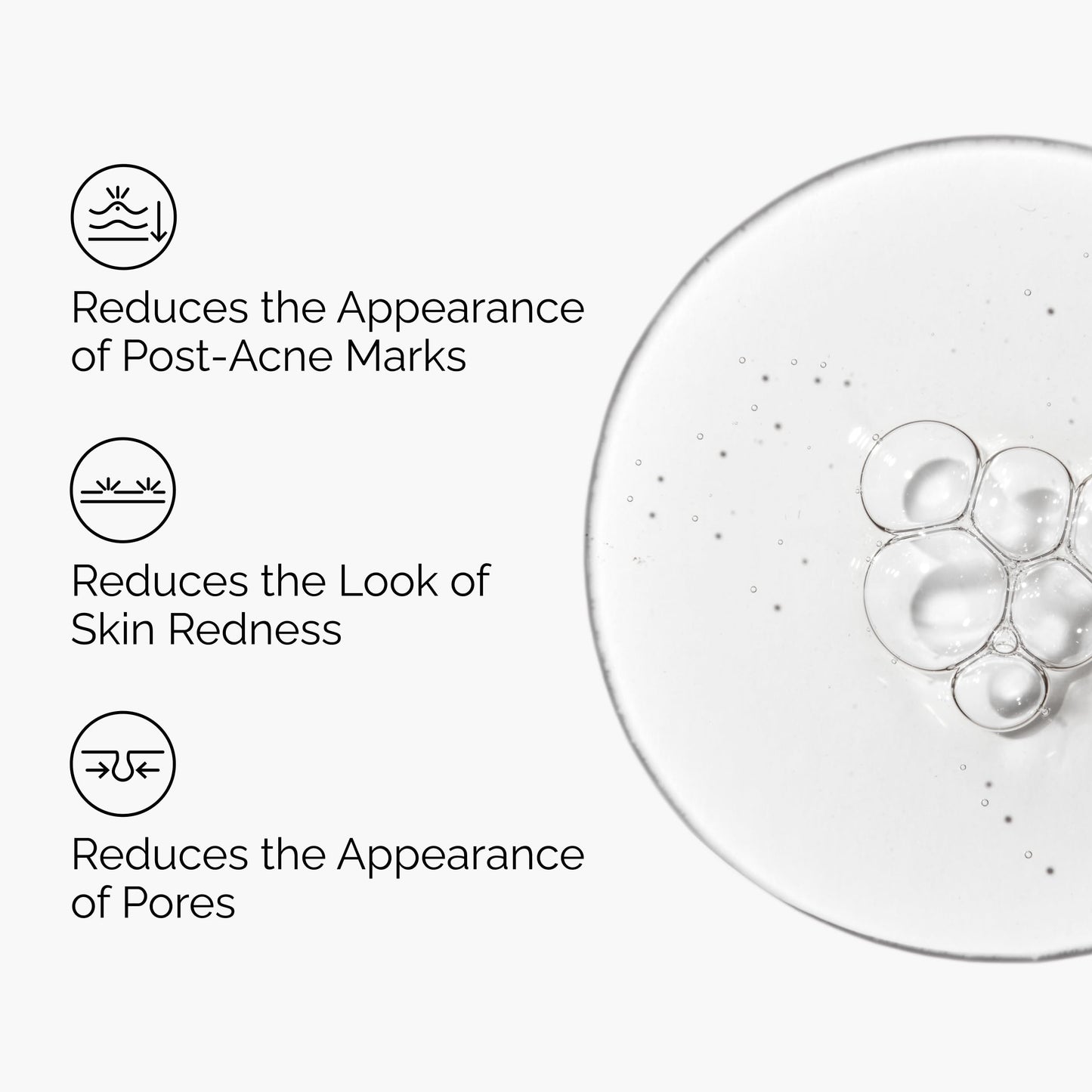 The Ordinary Aloe 2% + NAG 2% Solution, Soothes Skin and Targets Post-Acne Marks, 1 Fl Oz