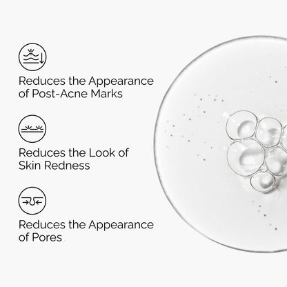 The Ordinary Aloe 2% + NAG 2% Solution, Soothes Skin and Targets Post-Acne Marks, 1 Fl Oz