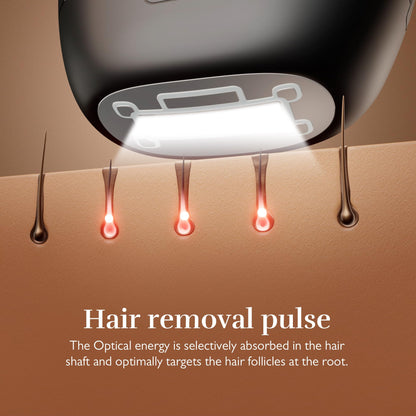 Silk'n 7 IPL Laser Hair Removal Device for Women and Men with Rotating Head, Painless Permanent Hair Reduction at Home for Face and Body in 7 Mins, 3 Smart Attachments and Automatic Skin Sensor, Black