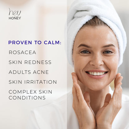 Hey Honey Skincare Relax - Instant Rosacea Relief Cream for Sensitive Skin | Calming Face Moisturizer for Facial Redness & Irritation | Dermatologist Tested, Oil-Free with Honey & Propolis | 2.2 Oz