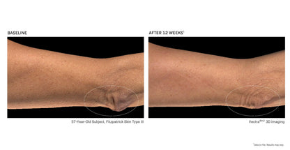 Revision Skincare BodiContour™,Contouring Body Lotion with iFirm® Technology, Firms,Tightens & Lifts Sagging,Crepey Skin,Enhances Results with Body Contouring & Weight Loss Medications