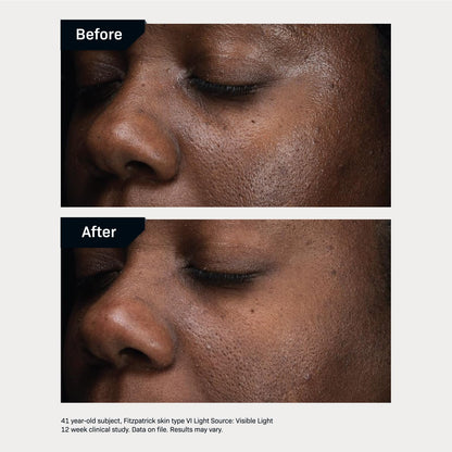 Revision Skincare D·E·J Daily Boosting Serum™, Anti Aging Serum, Reduces Wrinkles, Supports Skin Firmness and Skin Elasticity