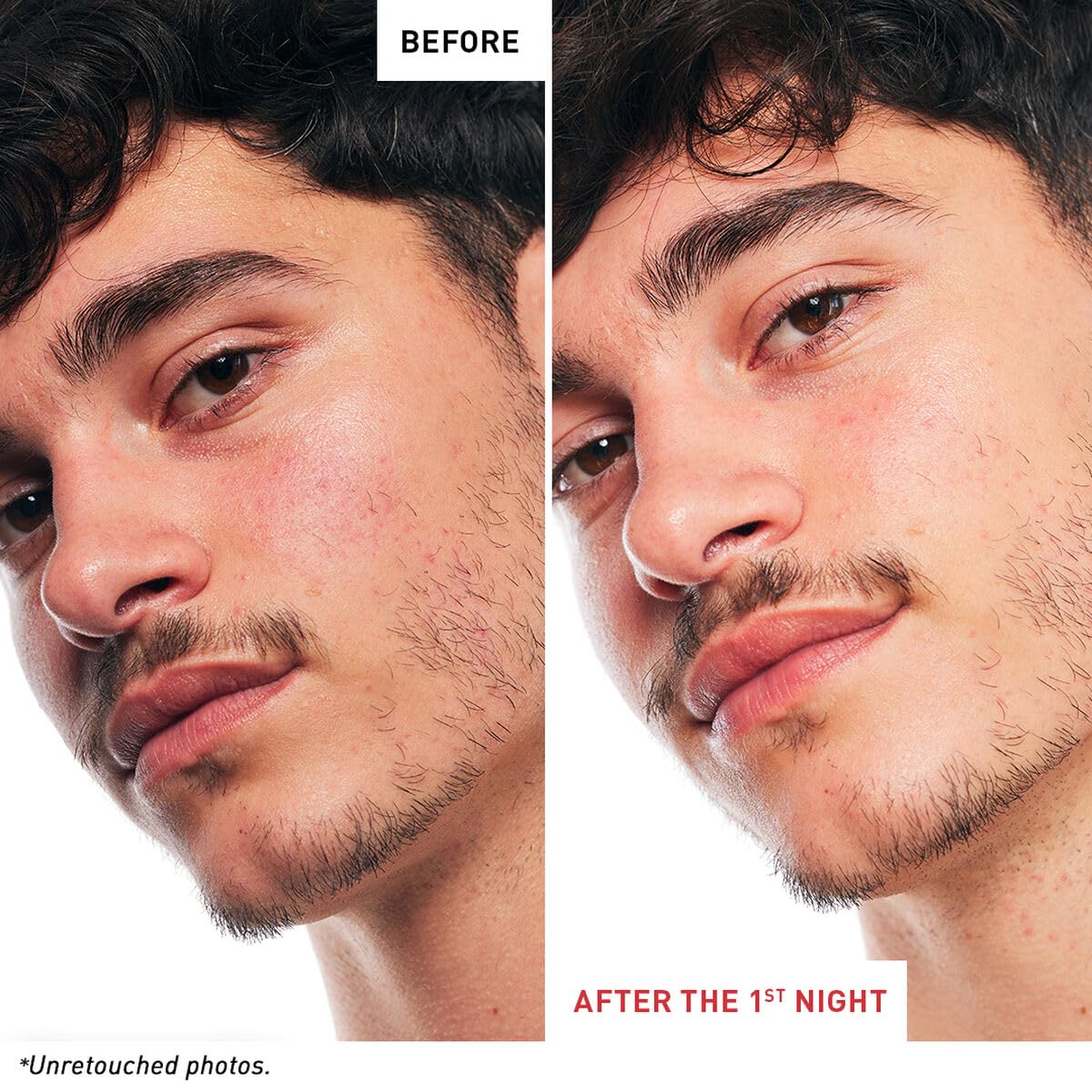 Erborian Multi‑Perfecting Night Serum, Oil & Milky Formulas, Smooths, Even Texture, Hydrates, Firms For Glowy, Mirror Skin Renewal, Korean Skincare