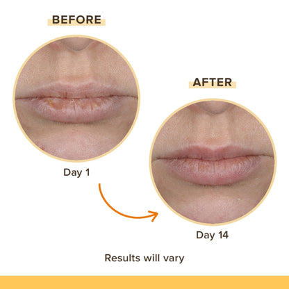 Burt's Bees Rescue Balm Unscented Lip Balm, With Antioxidant-Rich Turmeric, Tint-Free, Natural Origin Lip Care, 2 Tubes, 0.15 oz.