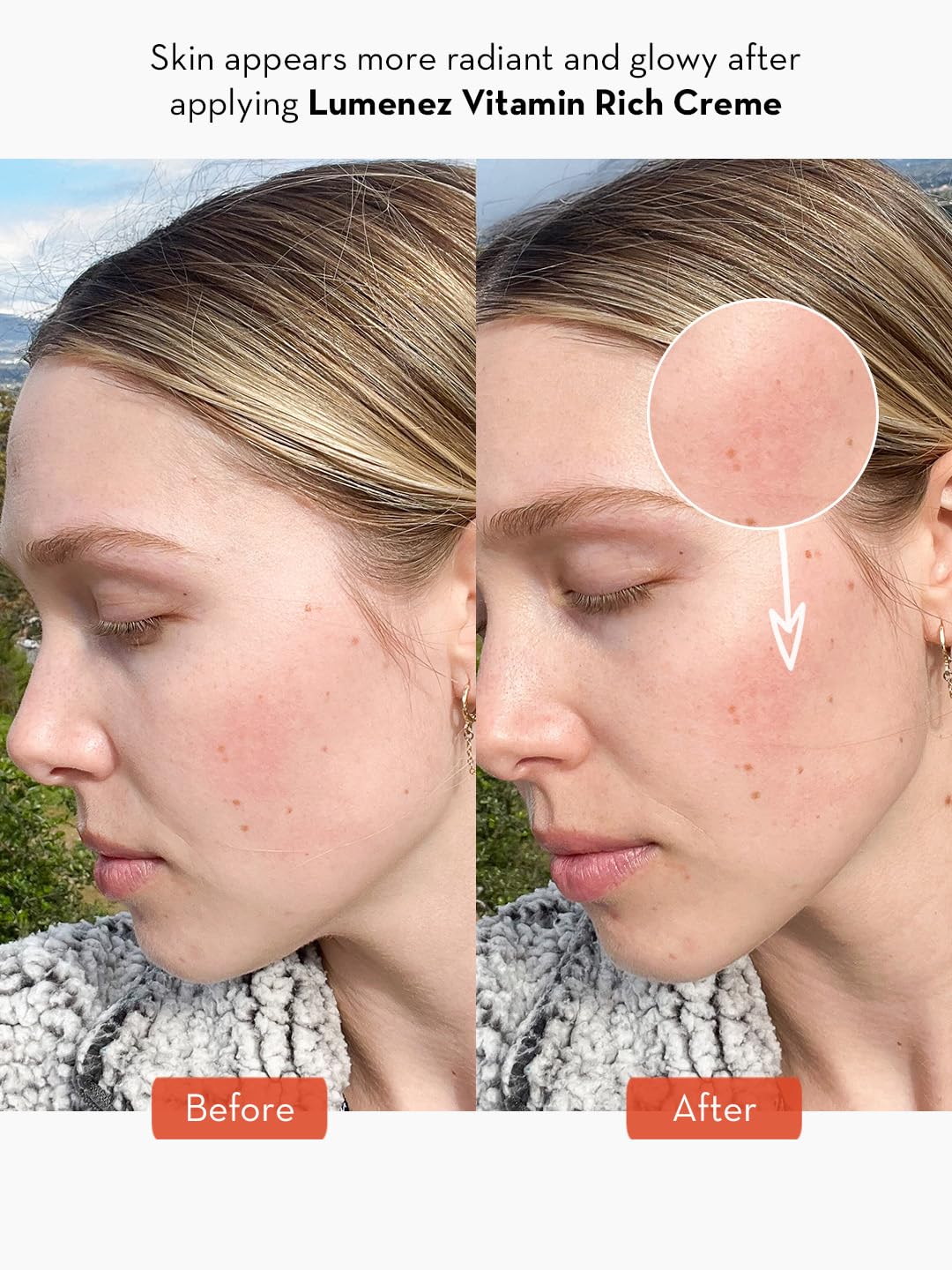 SONAGE Lumenez Vitamin Facial Cream: Daily Restorative Moisturizer with Vitamin C | Hydrating Cream for Dry Skin