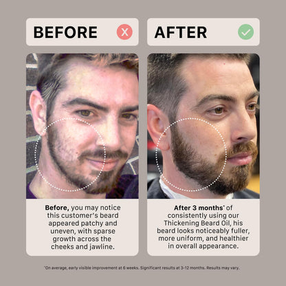 ACTIIV Thickening Beard Oil | Promotes Thicker Fuller Beard Growth, Nourishes & Softens Facial Hair, Lightweight Non-Greasy Formula, Vegan, Plant-Based, All Beard Types