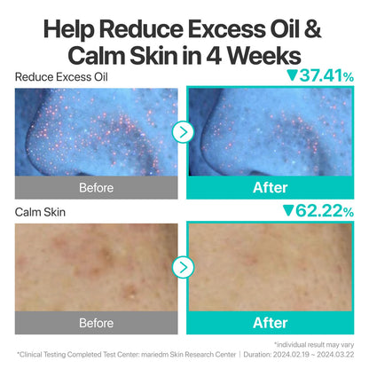 numbuzin No.1 Serum | Pantothenic B5 Active Soothing Serum | Soothing, Hydrating | Pantothenic Acid, Niacinamide | Excess Oil Control, Reduces Breakouts, Acne | Oily, Acne-Prone Skin | 1.69 fl. oz.