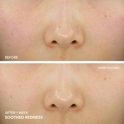 innisfree Green Tea Ceramide Cream, Hydrating Rescue Cream for Dry, Sensitive, and Eczema Prone Skin