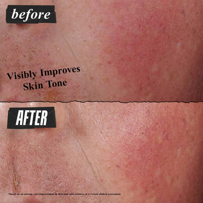 Kiehl's Ultra Facial Advanced Repair Barrier Cream, Intensive Treatment Relieves Dry + Sensitive Skin, Rapidly Reduces Redness and Soothes, Fast-Absorbing Breathable Formula, Paraben-Free - 1.7 fl oz