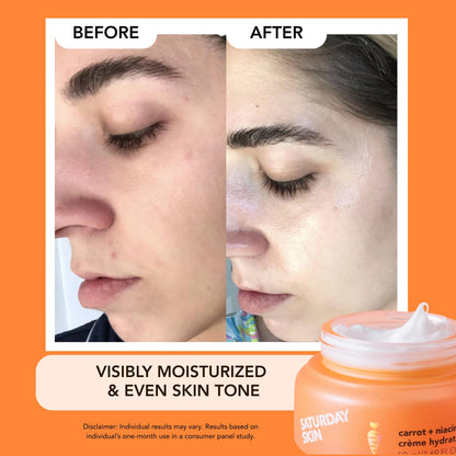 Saturday Skin Face Moisturizing Cream with Carrot, Niacinamide, Ceramides & Centella Asiatica, Peptide, Paraben-Free, Sulfates-Free, Fragrance-Free, Anti Wrinkle Facial Cream(1.61 Ounce)