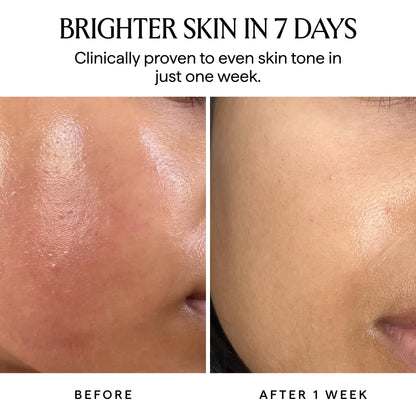 HERBIVORE Nova 15% Vitamin C + Turmeric Brightening Serum for Dark Spots, Hyperpigmentation + Even Skin Tone | Vegan, Plant-Based, Cruelty-Free, 30 mL / 1 oz