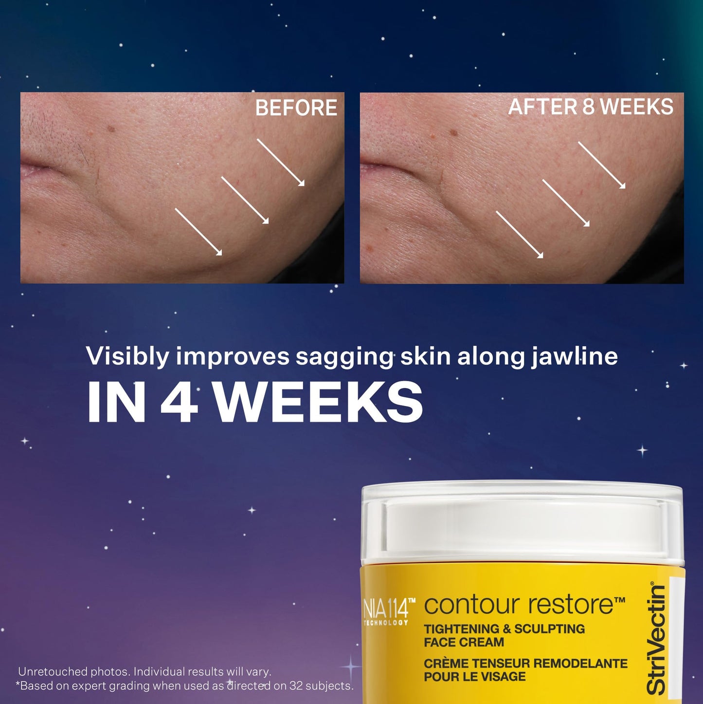 StriVectin TL Advanced Holiday Duo Tighten and Sculpt Kit, Brighten and Lift Skin Tone, Peptides and Hyaluronic Acid