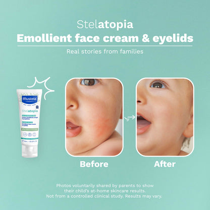 Mustela Stelatopia Eczema-Prone Skin Emollient Baby Face Cream - Face Moisturizer with Natural Avocado & Sunflower Oil - Fragrance-Free - 1.35 Fl Oz (Pack of 1)