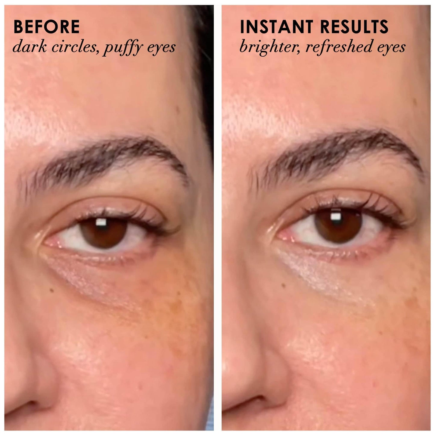 Dermelect Revitalite Eyelid & Dark Circle Corrector- Professional Strength, Anti-Aging Eye Cream with Peptides, Brightening & Tightening Ingredients- Dark Circles, Puffiness, Droopy Eyelids & Wrinkles
