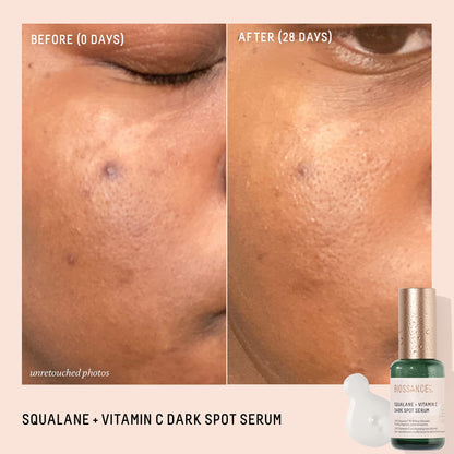 Biossance Squalane + Vitamin C Dark Spot Face Serum – 10% Vitamin C Serum & White Shiitake – Hydrating, Fragrance-Free, Non-Irritating, for Daily Use for All Skin Types