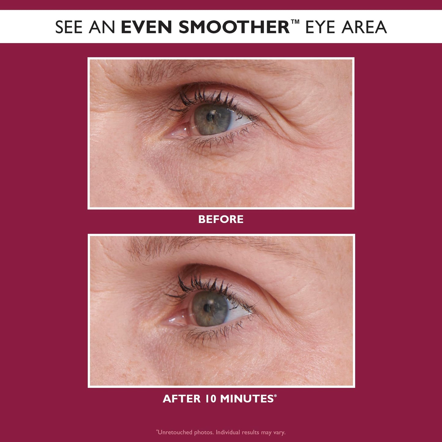 Peter Thomas Roth | Even Smoother™ Glycolic Retinol Hydra-Gel Eye Patches, Under-Eye Patches With Glycolic Acid and Retinol, Treats Tiny Bumps, Texture, Fine Lines and Wrinkles Under the Eye Area