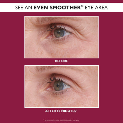 Peter Thomas Roth | Even Smoother™ Glycolic Retinol Hydra-Gel Eye Patches, Under-Eye Patches With Glycolic Acid and Retinol, Treats Tiny Bumps, Texture, Fine Lines and Wrinkles Under the Eye Area