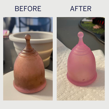 Pixie Cup Stain Remover - The Only Sterilizer Cleaner that Will Remove Stains On Your Reusable Menstrual Discs & Period Cups - Organic and Natural Ingredients for Feminine Care (5 Packets)