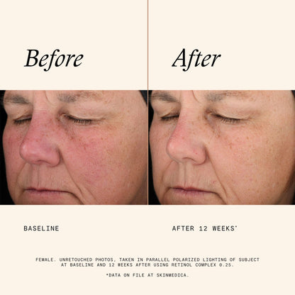 SkinMedica Retinol