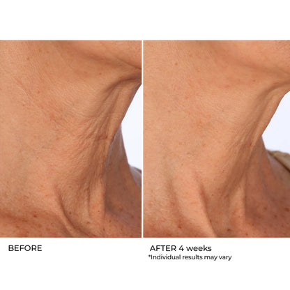 NassifMD Age Defying Neck & Décolleté Serum, Lifts and Firms Thin Neck Skin, Hydrates and Smooths