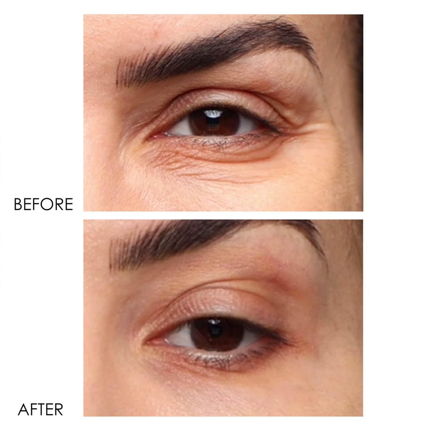 Dermelect Revitalite Eyelid & Dark Circle Corrector- Professional Strength, Anti-Aging Eye Cream with Peptides, Brightening & Tightening Ingredients- Dark Circles, Puffiness, Droopy Eyelids & Wrinkles