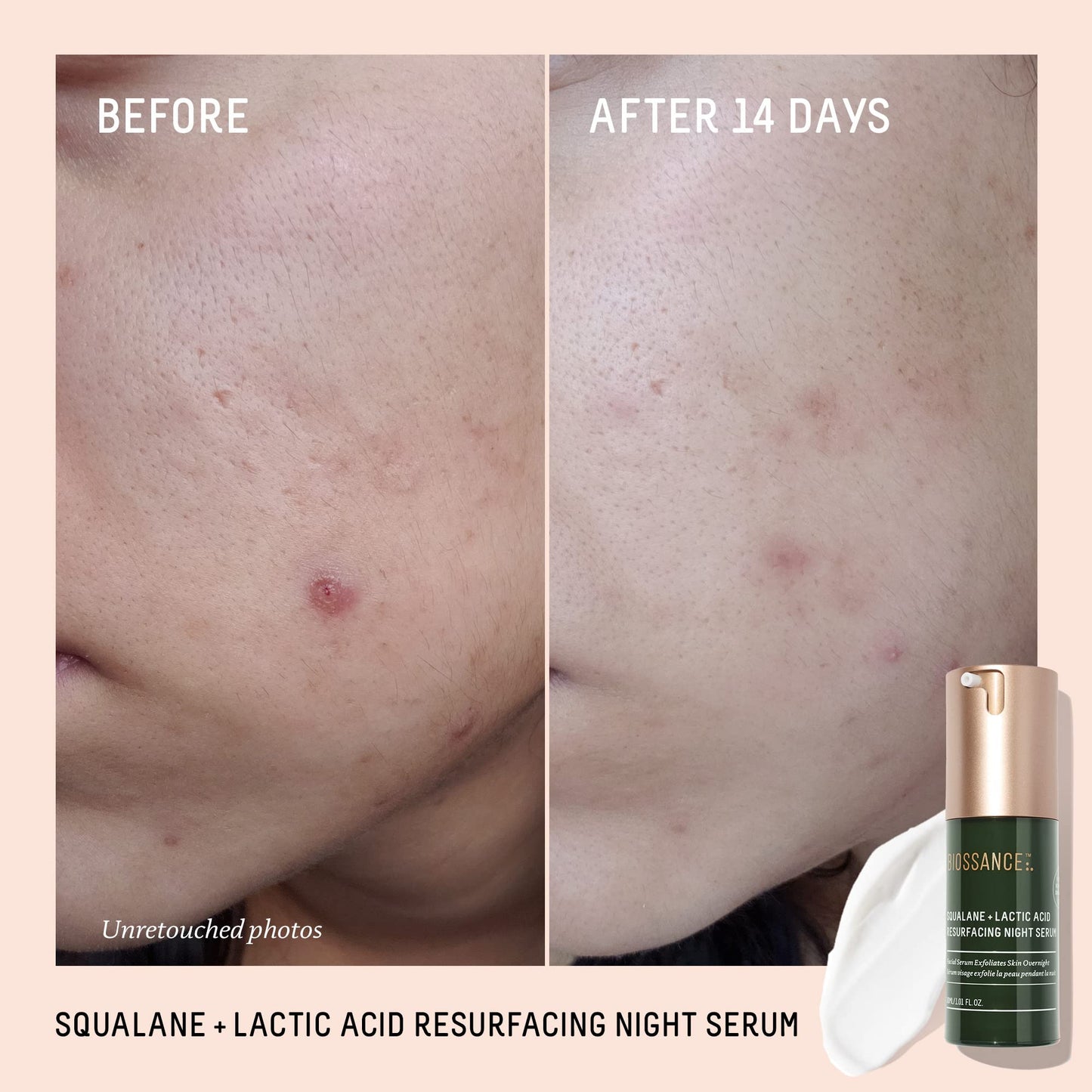 Biossance Squalane + Lactic Acid Resurfacing Night Serum - Vegan 10% Lactic Acid Face Serum for Skin Texture and Fine Lines - Gentle Night Exfoliant, Hydrating - Pore Reducer for Face, 1.0 Ounce