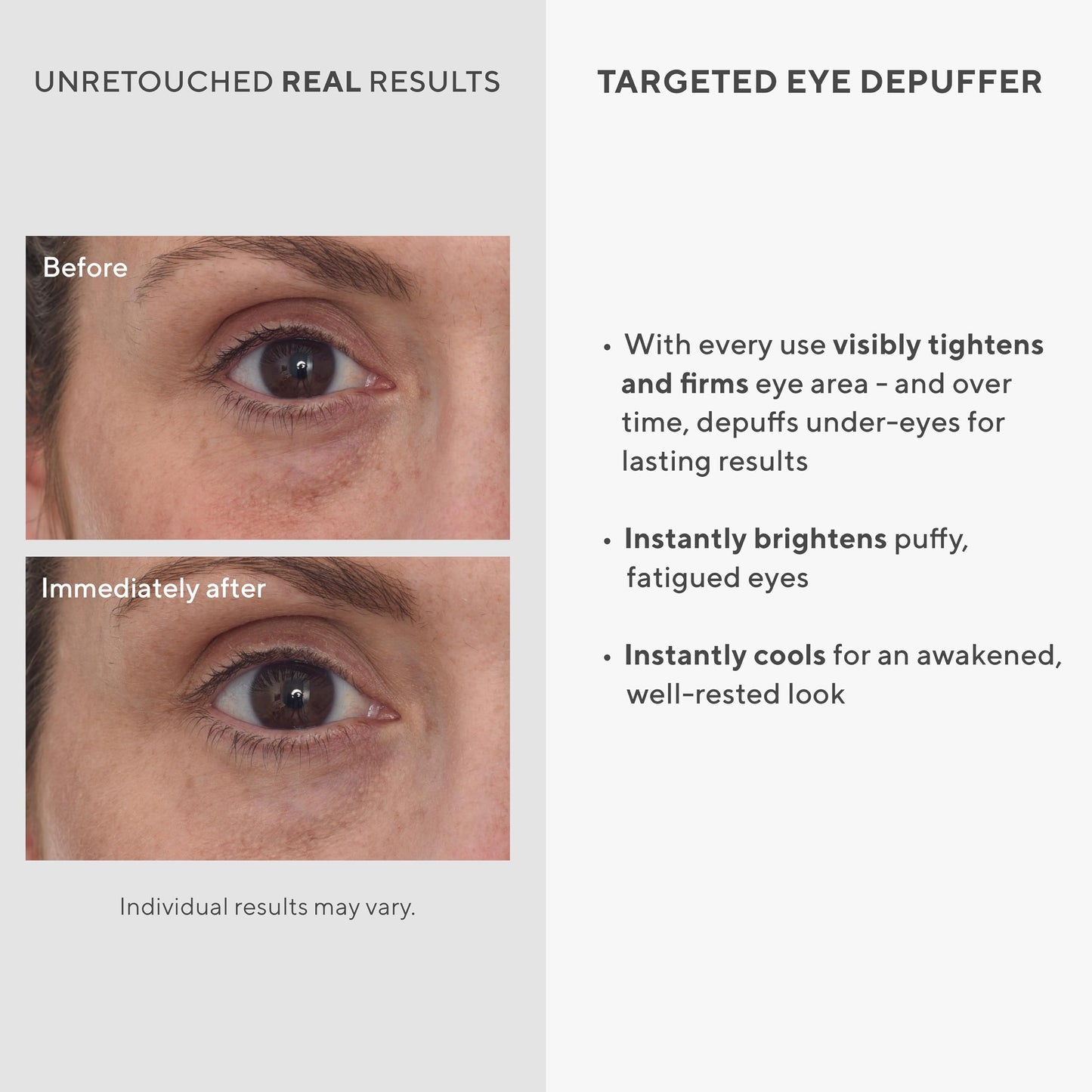 Murad Targeted Eye Depuffer – Ginseng, Lily, and Caffeine Eye Cream Fights Fatigued and Stressed Appearance by Brightening, Depuffing, and Firming Under-Eye Bags – 0.5 Fl Oz