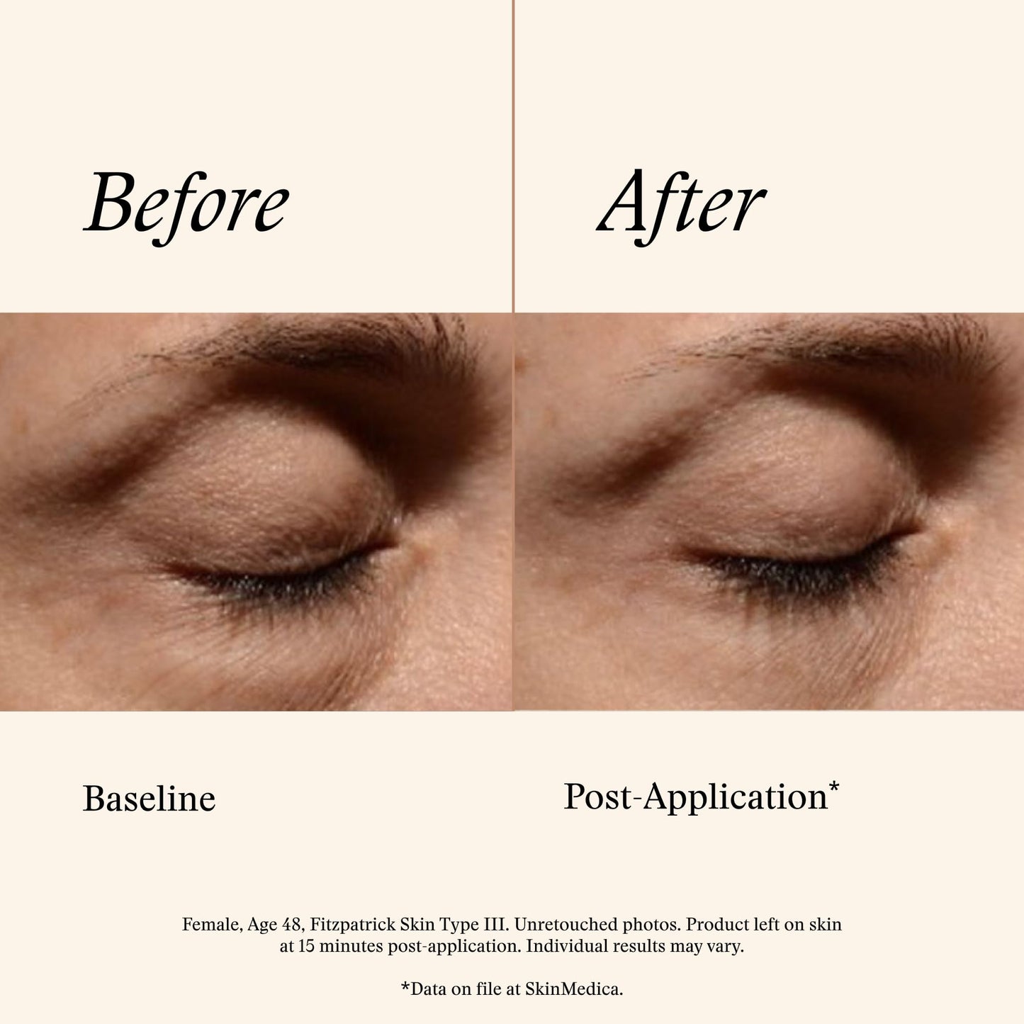 SkinMedica Instant Bright Eye Cream - Our Age-Defying Under the Eye Cream Instantly Improves Eyes’ Appearance, Including Dark Circles, Sagging, Puffiness and Lines
