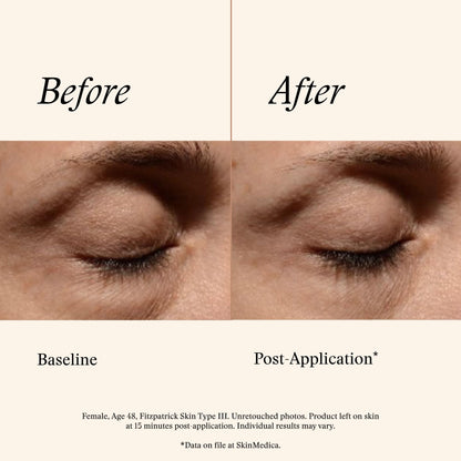 SkinMedica Instant Bright Eye Cream - Our Age-Defying Under the Eye Cream Instantly Improves Eyes’ Appearance, Including Dark Circles, Sagging, Puffiness and Lines