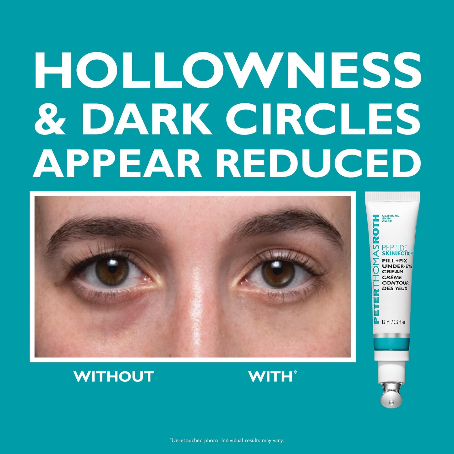 Peter Thomas Roth | Full-Size Peptide Skinjection™ Solutions 2-Piece Face & Eye Kit | Anti-Aging Peptide Skincare Set, Under-Eye Cream and Moisturizer